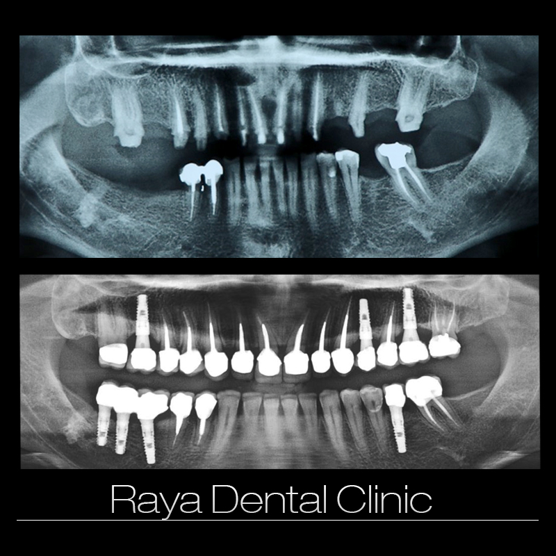 تصویر دندان