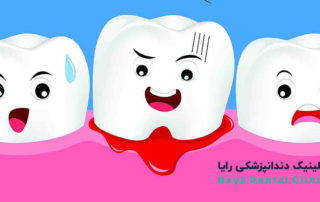 Bleeding-Implant-Gums-Teeth-RAYADENTALCLINIC