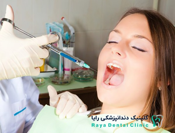 مراحل کشیدن دندان-دندانپزشکی شبانه روزی رایا