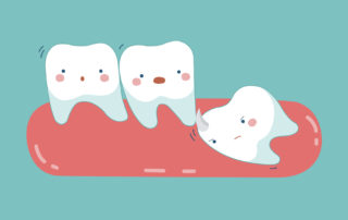 نهفتگی دندان