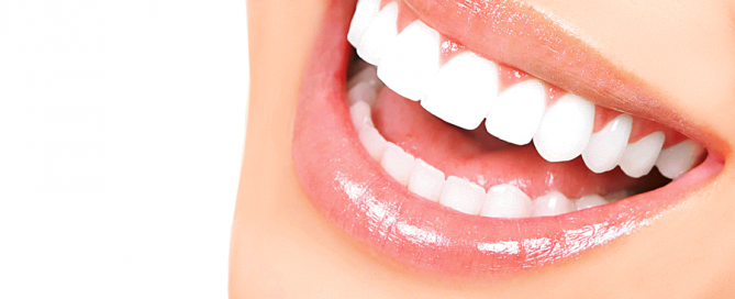 لمینت دندان چیست؟