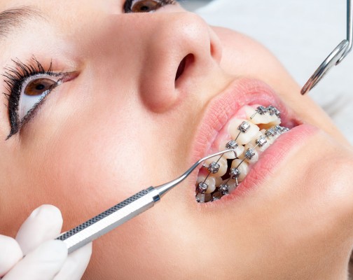 بررسی وضعیت ارتودنسی دندان
