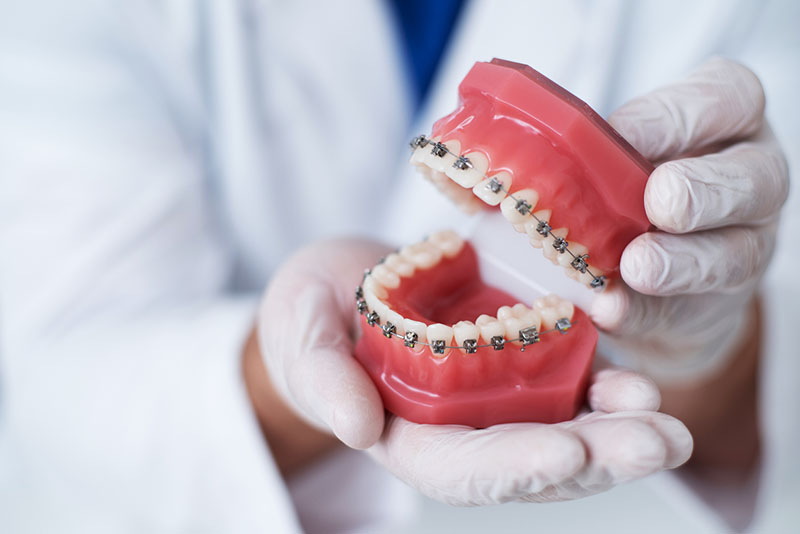 درمان دندان با ارتودنسی