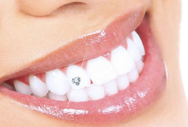 رعایت بهداشت بعد از پیرسینگ دندان