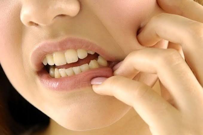 مراحل عمل عصب کشی دندان