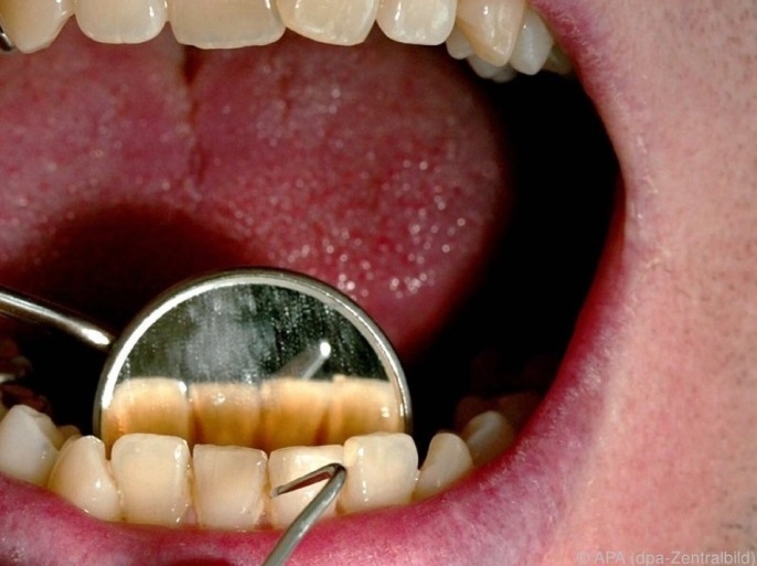 عوامل خطر پوسیدگی دندان