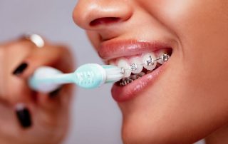 تمیز کردن ارتودنسی دندان