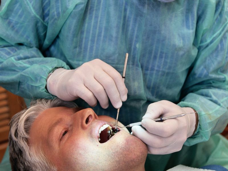 جراحی دندان در بیهوشی