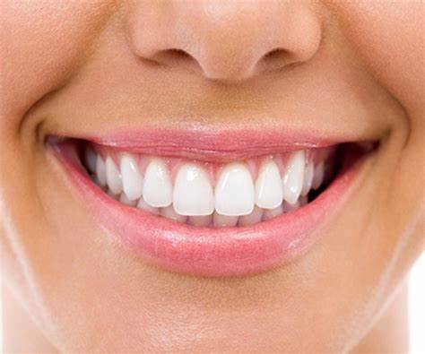 عوامل موثر با ماندگاری لمینت دندان