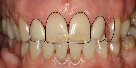 راه های بهبود مشکلات دندان