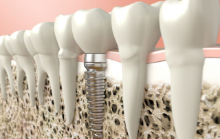 کاهش عفونت دندان