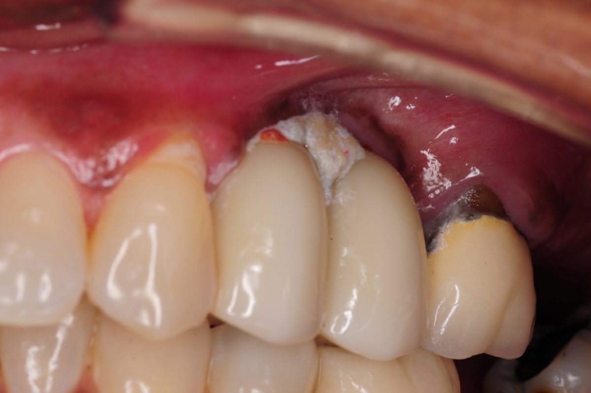 علت بیماری دهان و دندان