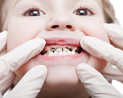 آسیب های احتمالی دندان کودکان