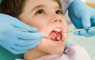 درمان سیاهی دندان ‌های کودکان