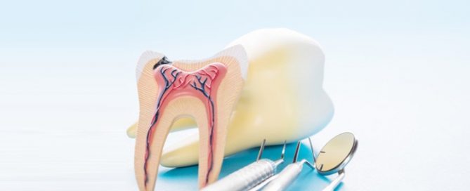 درمان ناقص ریشه دندان