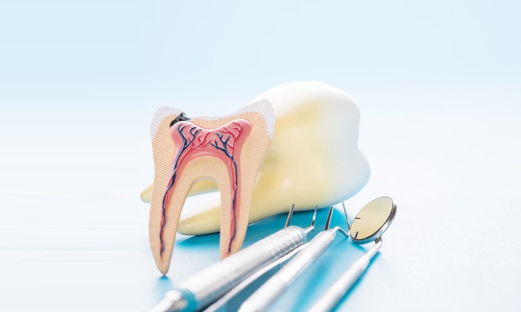 درمان ناقص ریشه دندان