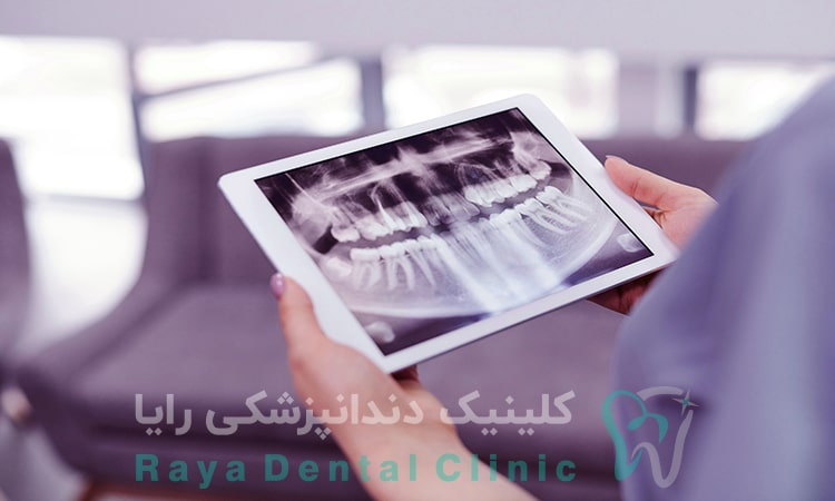 رادیولوژی و رادیوگرافی دیجیتال دندان( عکس OPG)