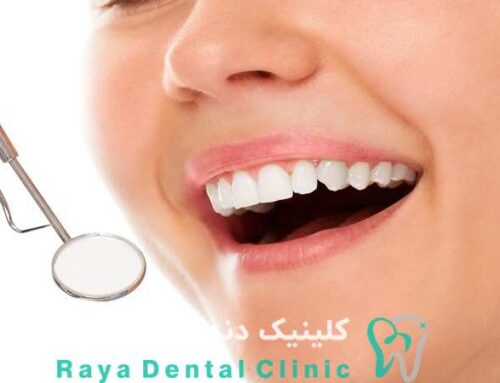 ترندهای جدید در دندانپزشکی زیبایی و طراحی لبخند ۲۰۲۵
