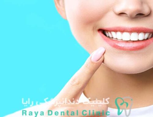 نقش اصلاح لثه در ایجاد طرح لبخند جذاب