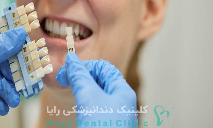 کاشت ایمپلنت اشترومن 
