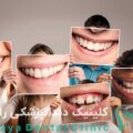 متخصص طرح لبخند