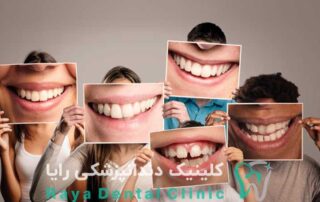 متخصص طرح لبخند