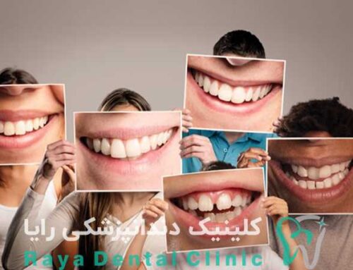 نکات مهم برای انتخاب بهترین متخصص طرح لبخند