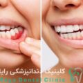 طراحی لبخند