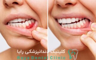 طراحی لبخند