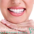 دندانپزشکی زیبایی برای طرح لبخند