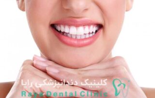 دندانپزشکی زیبایی برای طرح لبخند
