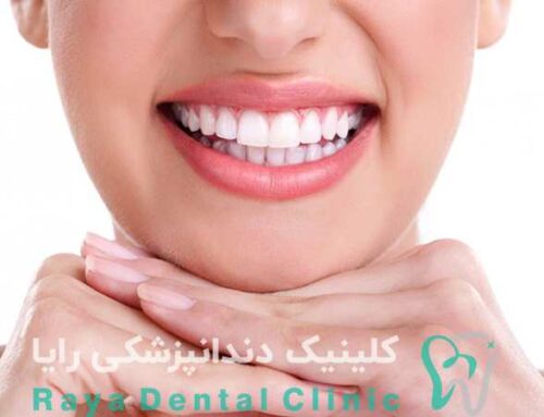بهترین مواد و متریال‌ ها در دندانپزشکی زیبایی برای طرح لبخند