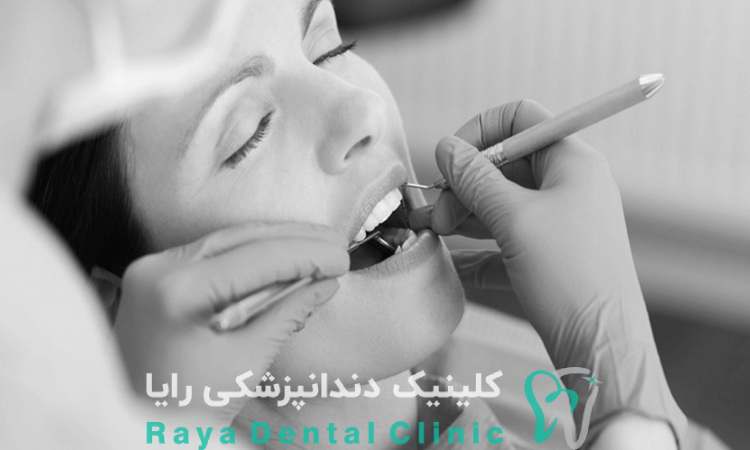 سدیشن چیست؟