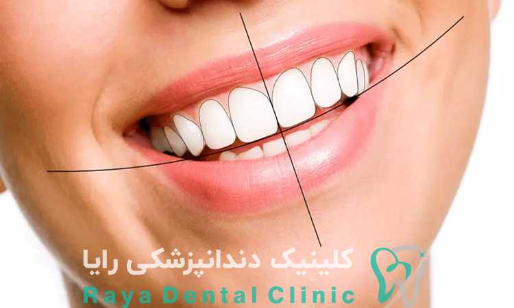 طرح لبخند 