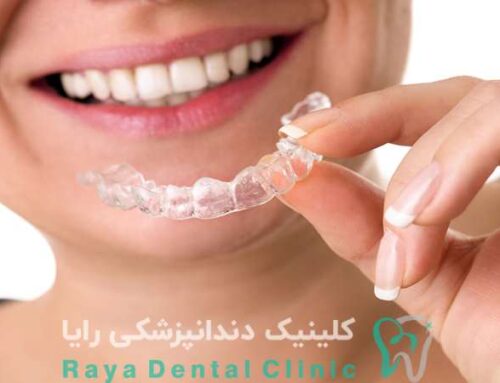 ترکیب ارتودنسی نامرئی با طراحی لبخند دیجیتال