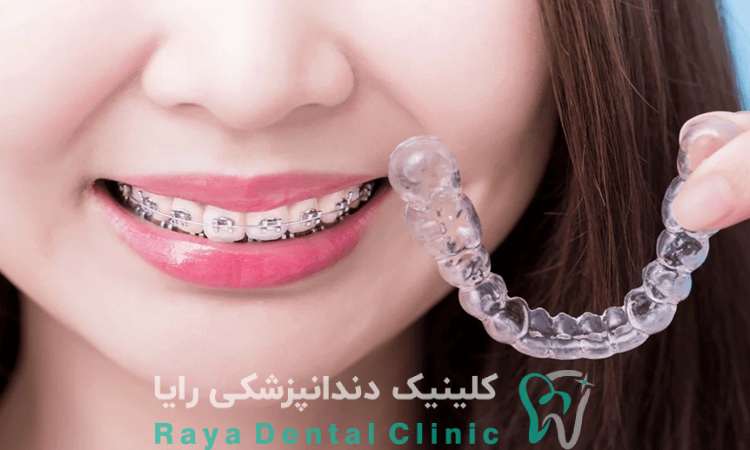 ارتودنسی نامرئی چیست 