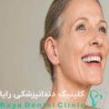 طراحی لبخند