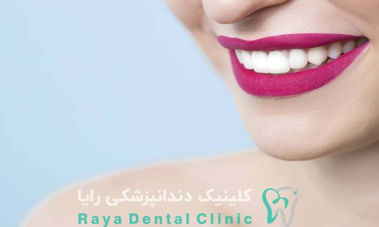طراحی لبخند