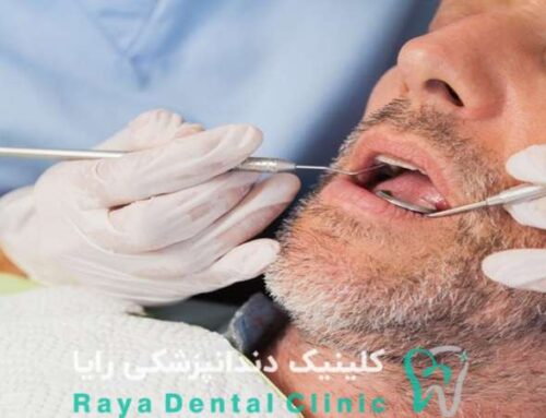 نکات مهم قبل از انجام سدیشن دندانپزشکی