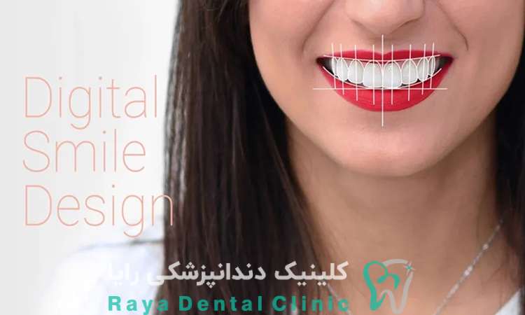 طراحی لبخند دیجیتال