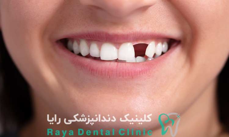 متخصص ریشه
