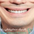 طراحی‌ لبخند مصنوعی