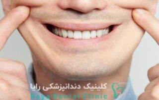 طراحی‌ لبخند مصنوعی