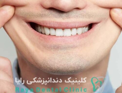 چرا برخی طراحی‌ های لبخند مصنوعی به نظر می‌ رسند؟