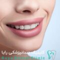 طراحی لبخند