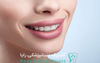 طراحی لبخند