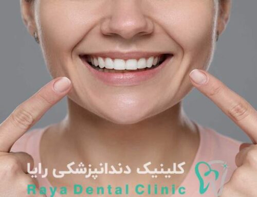 اصلاح طرح لبخند در چه سنی باید انجام شود؟