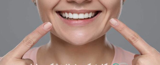 اصلاح طرح لبخند