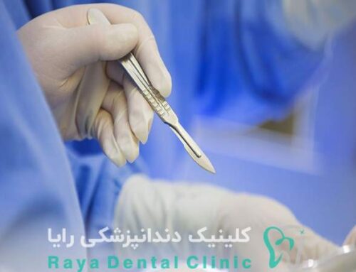 ایمپلنت دیجیتال بدون تیغ جراحی: واقعیت یا تبلیغ؟