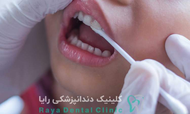 اهمیت فلورایدتراپی